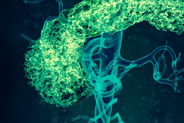 Кардіометаболічні порушення